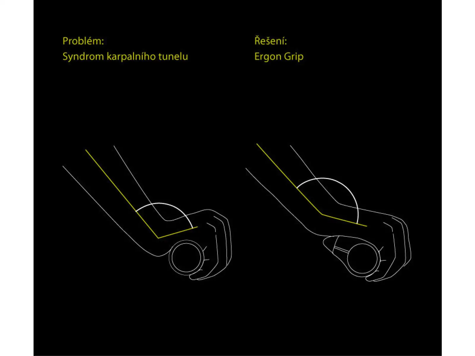 Ergon GP5 BioKork ergonomické gripy s rohmi